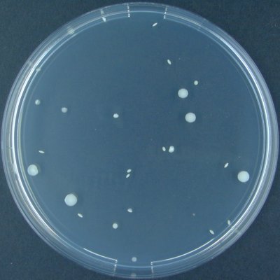 escherichia coli 10 * 2 в моче