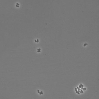 Aerococcus viridans