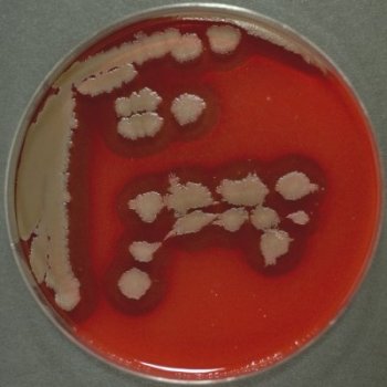 Bacillus cereus