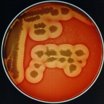 Bacillus cereus