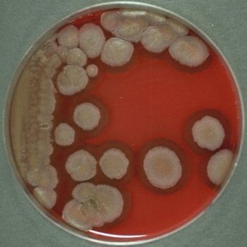 Bacillus cereus