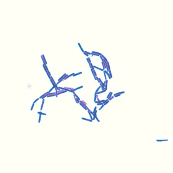 Bacillus cereus