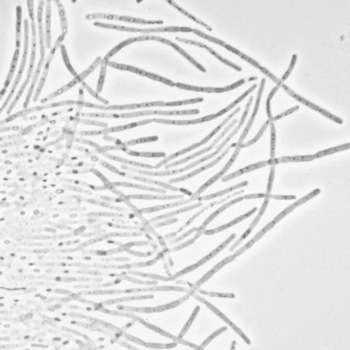 Bacillus cereus