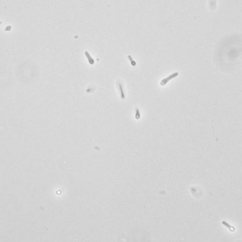 Bacillus sphaericus
