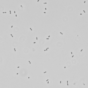 Lactococcus lactis
