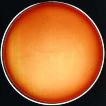 Leuconostoc mesenteroides