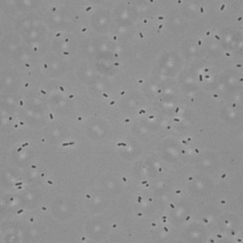 Listeria ivanovii