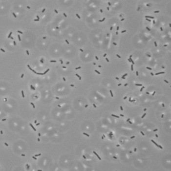 Listeria seeligeri