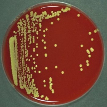 Micrococcus luteus