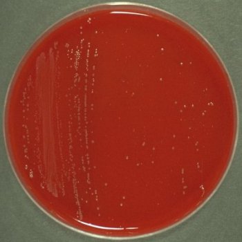 Paenibacillus macerans