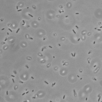 Salmonella enterica