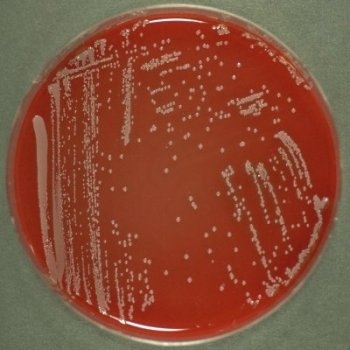 Staphylococcus aureus