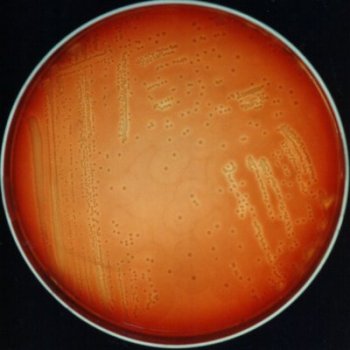 Staphylococcus aureus
