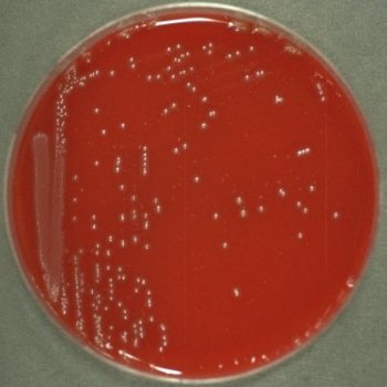 Streptococcus agalactiae