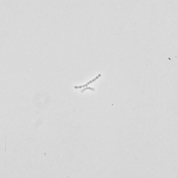 Streptococcus agalactiae