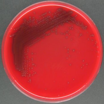 Streptococcus uberis