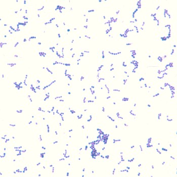 Streptococcus zooepidemicus