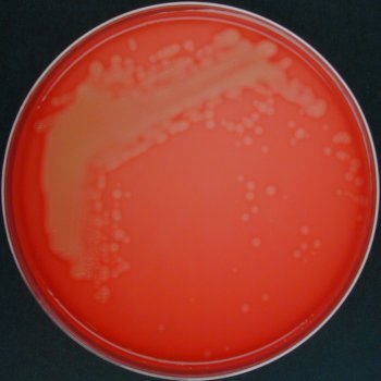 Streptococcus uberis