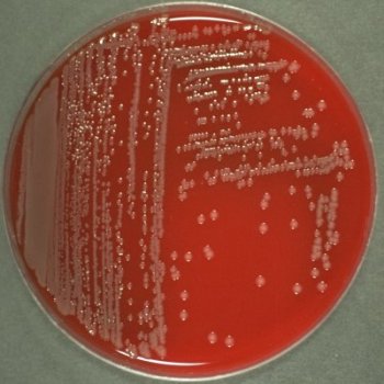 Vibrio parahaemolyticus