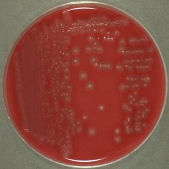 Clostridium perfringens