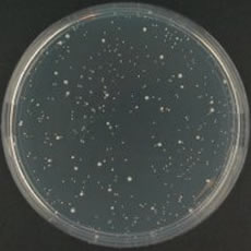 Clostridium perfringens