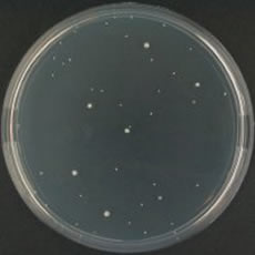 Clostridium perfringens