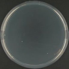Clostridium perfringens