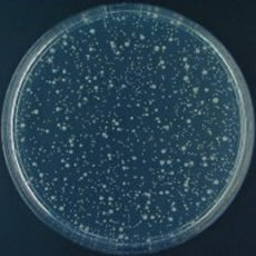 Escherichia coli