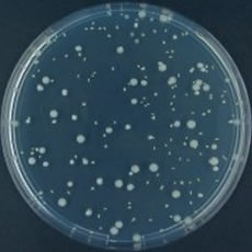 Escherichia coli