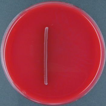 Aesculin Blood Agar