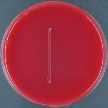 Aesculin Blood Agar