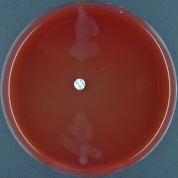Neggram What Bacteria Are Resistant To Nalidixic Acid? – YVDL