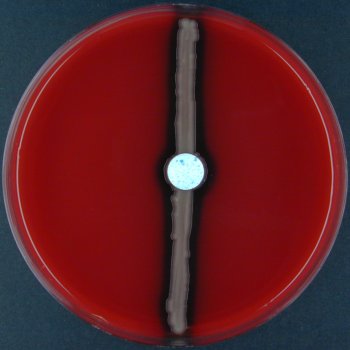 Sensitivity to O/129