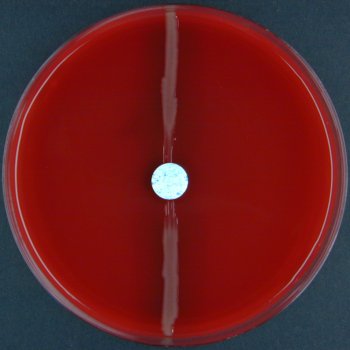 Sensitivity to O/129