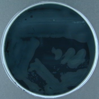 Charcoal Cephoperazone Desoxycholate Agar