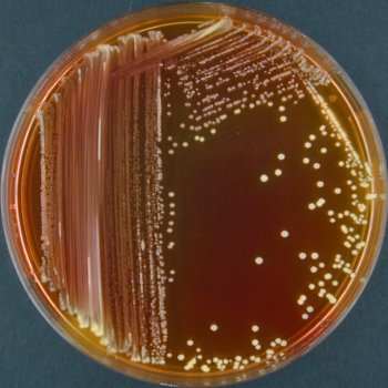 Xylose-lysin-desoxycholat-agar
