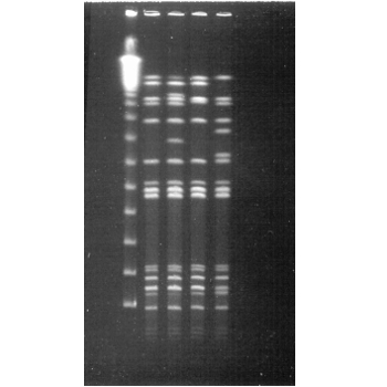 Pulsed field gel electrophoresis  (PFGE)