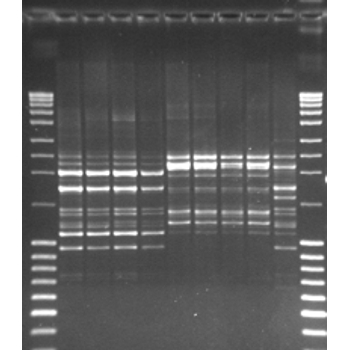 Repetetive element based PCR (rep-PCR) typing