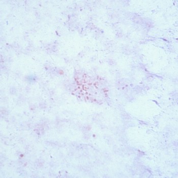 Actinobacillus equuli