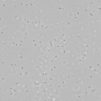 Actinobacillus equuli