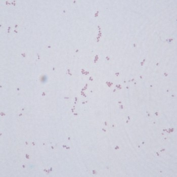 Actinobacillus lignieresii