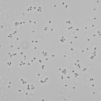 Actinobacillus lignieresii