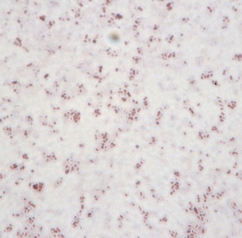 Actinobacillus pleuropneumoniae