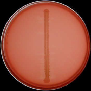 Actinobacillus pleuropneumoniae