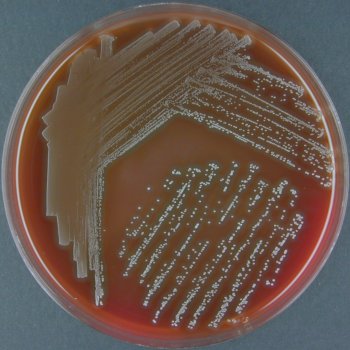 Arcanobacterium pyogenes