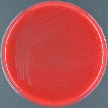 Arcanobacterium pyogenes