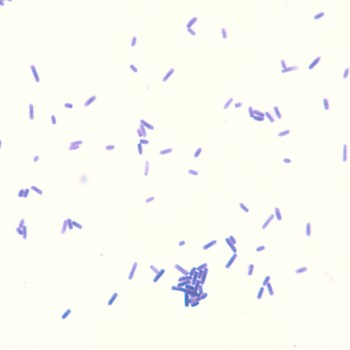Clostridium perfringens