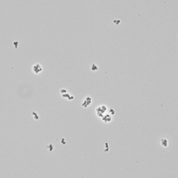 Corynebacterium pseudotuberculosis