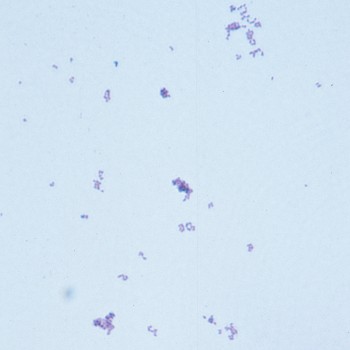 Corynebacterium pseudotuberculosis