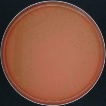 Corynebacterium renale